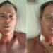Cipollini dopo il nuovo intervento: “Sento una frequenza cardiaca lineare”